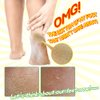 Elizavecca/Foot Peel /1 Foot Pack 2 Pairs Foot Mask - Boots for Exfoliating/foot pack review/foot pack before and after