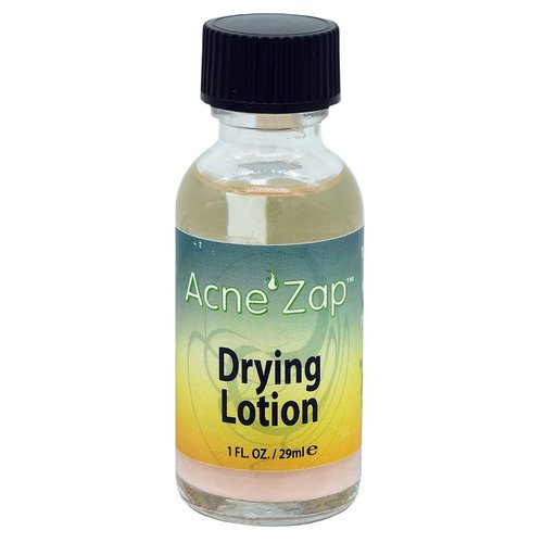 Acne Zap Drying Lotion - Overnight Acne Spot Treatment Dries Out Blemishes, Zits, Whiteheads, Pimples and Blackheads - Extra Strength Natural Solution for Acne Prone Skin - 1 fl oz