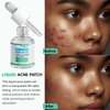 Fcoget Acne Spot Treatment Serum for Face, with 2% Salicylic Acid & 4% Niacinamide Face Serum, Liquid Pimple Patch for Acne Prone Skin, Soothing Redness, Clearing Oil Skin Care for Teens & Adults