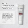 Glytone Acne Spot Treatment Face Cream with 8% Sulfur & 2% Resorcinol, Tinted Acne Treatment for Teenagers, Conceals Blemishes, 1 oz