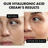 Hyaluronic Acid Face Moisturizer for Women and Men - Anti Aging Face Lotion Facial Moisturizer, Anti Wrinkle Hydrating Face Cream, Antiaging Hydrating Moisturizer, Day and Night Hyaluronic Cream