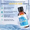 Ragkun Fast-Acting Skin Tag Remover Wart Remover with Salicylic Acid, Wart Removal for Women Men, Wart Freeze Off for Plantar Wart,Flat,Common, Corn,H Wart, Callus 30ML