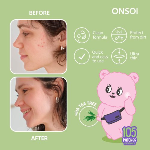 Innerest ONSOI 105 Blemish Patch - Hydrocolloid Pimple Patches for Face, Acne Spot Treatment-Tea Tree