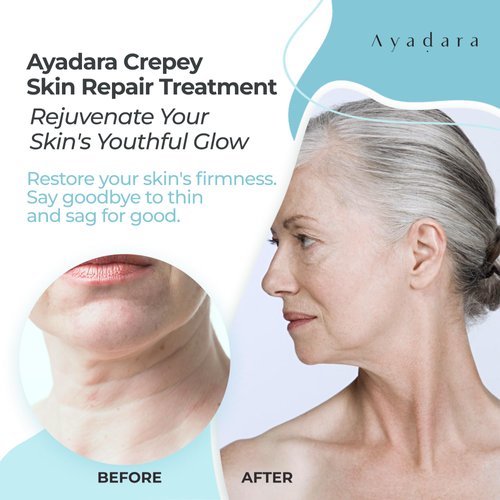 AYADARA Crepey Skin Repair Treatment 8oz, Firming Lotion for Loose Skin, Crepe Corrector Collagen Cream for Body Skin-Tightening, Wrinkle Cream for Face, Neck, Arms and Legs, 500+ Uses