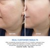 WNP Ultra-Hydrating Serum 3% Hyaluronic Acid, Skin Repair|Glass Skin|Anti-Aging serum for face, Single-Use Vials Skincare for Sensitive skin|4D Hyaluronic Acid(1.2 ml/0.04 fl.oz.)*30