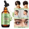 Rosemary Oil for Hair Growth, Rosemary Essential Oil, 100% Pure Natural, Reduce Hair Loss, Deeply Nourishing Scalp, Improves Blood Circulation