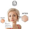Anti Aging Resurfacing Exfoliating Peel Pads Treatment- Contains Lactic, Salicylic, & Glycolic for Face & Body. Repairs Fine Lines, Wrinkles, Dark Spots, Pores, Acne Scars & Uneven Skin Tone.