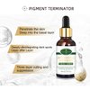 AICHUN BEAUTY Facial Serum Anti-Freckle Essence Nicotinamide Green Tea Extract Moisturizing Smooth Delicate 30ml/1fl.oz