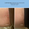 Bushbalm Ingrown Hair Oil - Helps with Ingrown Hair, Underarm Bumps, Soothes Skin, Razor Bumps and Post Shave Redness, 30 ml - Nude Oil