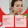 Wentoenapp 240 Pcs Star Pimple Patches,Pimple Patches for Face,Spot Stickers for Face and Skin Treatments and Masks, Pore Cleansing Strips