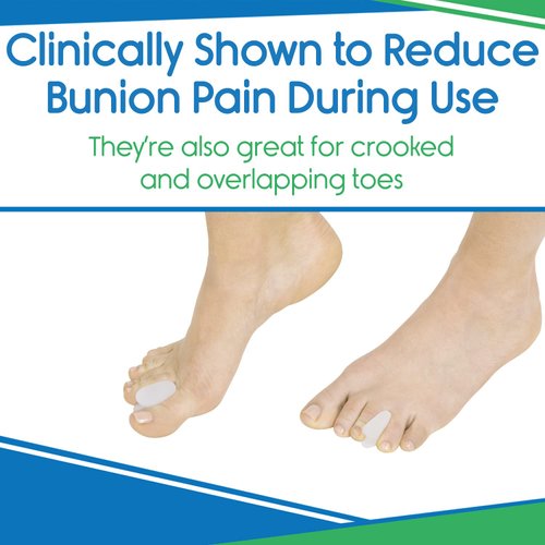 ViveSole Toe Spacer Separators (8 Pieces) - Overlapping Toes - Silicone Gel Spreaders for Men, Women - Bunion Pain Relief, Toe Alignment Corrector, Pedicure Aid - Orthotic Straightener