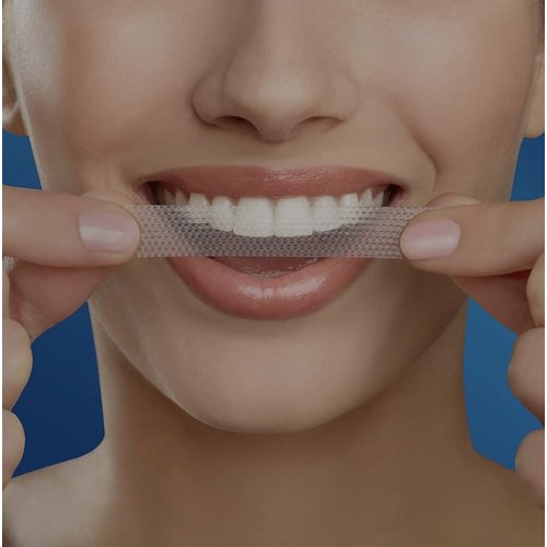 Crest 3D White Professional Effects Whitestrips Teeth Whitening Strips Kit, 40 Strips (20 Count Pack)