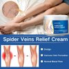 Uioecn 2Pcs Varicose Veins Cream, Skin Cream for Legs, Spider Varicose Veins ReliefCream