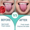 Tongue Scraper,Medical Grade Tounge Scraper Cleaner,Stainless Steel 100% BPA Free Metal Tongue Scrapers,Fights Bad Breath,Great For Oral Hygiene,Tongue Cleaners For Adults And Kids(Pack Of 2)
