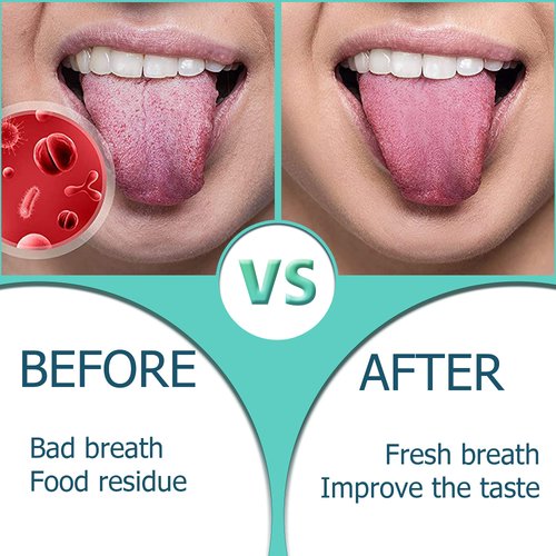 Tongue Scraper,Medical Grade Tounge Scraper Cleaner,Stainless Steel 100% BPA Free Metal Tongue Scrapers,Fights Bad Breath,Great For Oral Hygiene,Tongue Cleaners For Adults And Kids(Pack Of 2)