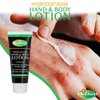 Dr. Dan's Hydrocortisone Hand and Body Lotion- 3 Pack- Anti Itch Lotion for Men and Women