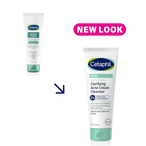 Cetaphil Gentle Clear Complexion-Clearing BPO Acne Cleanser with 2.6% Benzoyl Peroxide, Creamy and Soothing for Sensitive Skin, Suitable for All Skin Types, 4.2oz