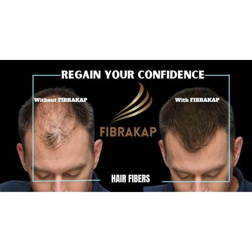 hair building fibers women and men, Conceals Hair Loss in Seconds, hair fibers composed of keratin (DARK BROWN)