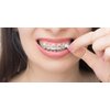 Genuine Orthowax - Orthodontic Wax for Braces Wearer - Stick Better Than competitors