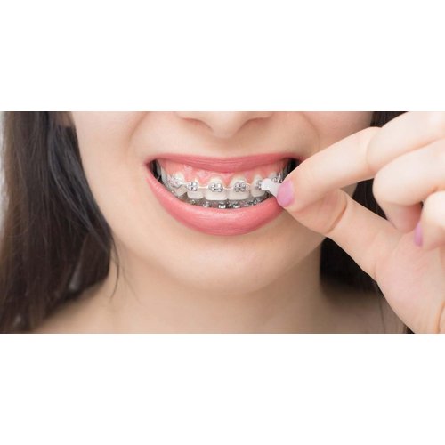 Genuine Orthowax - Orthodontic Wax for Braces Wearer - Stick Better Than competitors