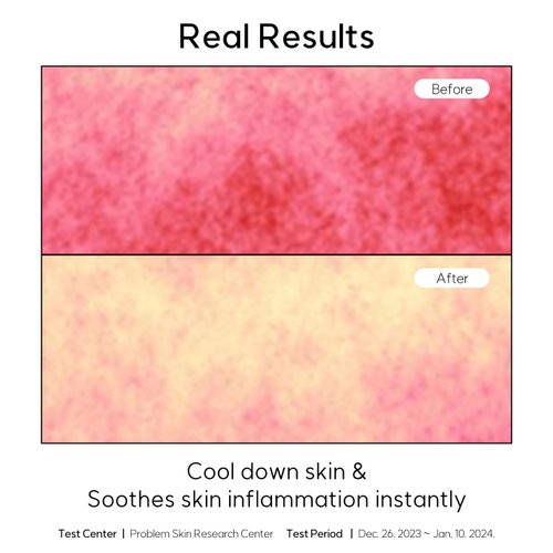 FROM NONE Madecassoside Blemish Control Toner Padsㅣ120 Pads, Vegan Face Gauze Pads, Improve Uneven Skin Tone, Centella Asiatica, Niacinamide, Low pH, Low-Irritant, for Sensitive Skin