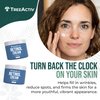 TreeActiv Retinol Cream, 2 oz, Retinol Cream for Face and Body, Gentle Retinol Moisturizer with Hyaluronic Acid, Moisturing Women and Mens Retinol Face Cream, Anti Aging Spot Wrinkle Cream, 400 Uses