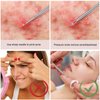 Titanium Lancet Needle Pimple Popper Tool Facial Milia Remover Blackhead Blemish Remover Blackhead Whitehead Extractor Professional Lancet Zit Blemish Comedone Removal Tool 2 Pieces with Box