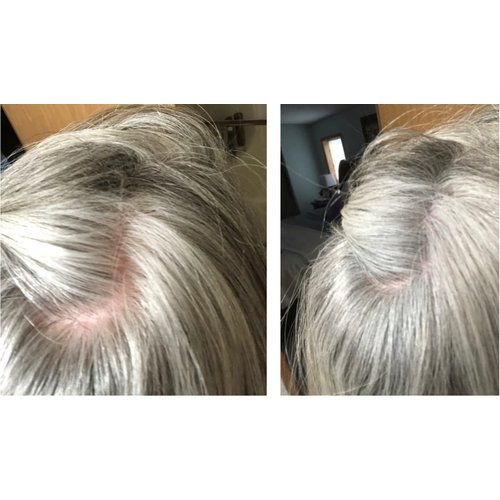 Caboki Hair Concealer (All-Natural Hair Building Fibers) Travel Size (Gray)