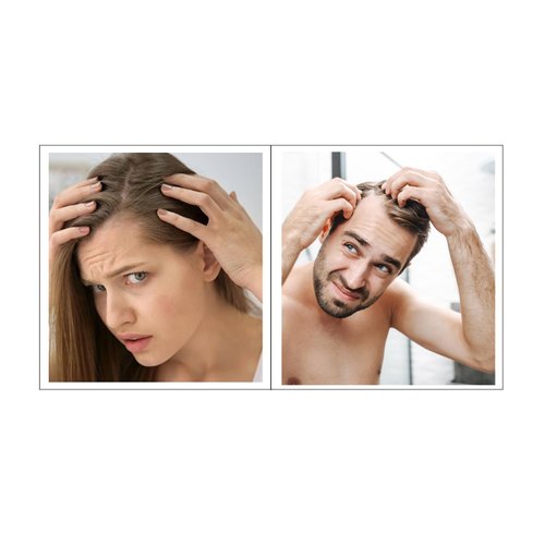 MOEHAIR Hair Guard Conditioner for Hair Loss Treatment | Anti-Hair Fall Conditioner | Helps Boos Hair and Scalp Health | Hydrates and Nourishes | Damage Repellant 12 Fl Oz (CON-Guard-12Fl-101)