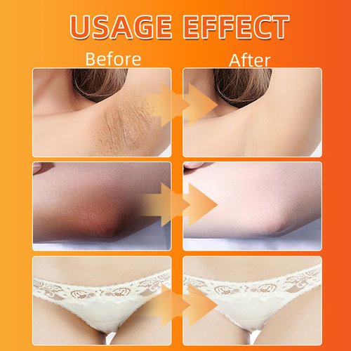 Nirraleza Skin Lightening Cream, Skin Bleaching Cream for Body Intimate Areas, Skin Whitening Cream with Vitamin C for Underarms, Knees, Armpits, Elbows, Inner Thighs and Bikini Areas