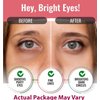 Look At Me Under Eye Patches (10 Pairs). Korean Skin Care Green Tea Hydrogel Eye Patch/Eye Pads. Dark Circle Remover and Collagen Eye Mask for Puffy Eyes. Gel Under Eye Brightener/Eye Depuffer