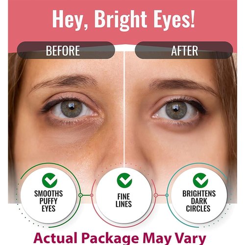 Look At Me Under Eye Patches (10 Pairs). Korean Skin Care Green Tea Hydrogel Eye Patch/Eye Pads. Dark Circle Remover and Collagen Eye Mask for Puffy Eyes. Gel Under Eye Brightener/Eye Depuffer