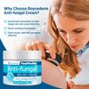 Roycederm Antifungal Cream, Athletes Foot Treatment Cream, Jock Itch Cream, Antifungal Treatment for Athletes Foot, Eczema, Psoriasis, Jock Itch, Anti Itch, Rash, Ringworm Treatment for Humans