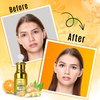Ginger Face Serum + Vitamin C + Turmeric, Organic Acne Treatment, Clear skin Tone, Hydrate Dull & Dry Skin, Anti-Aging Facial Serum - 1 FL OZ