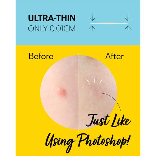 DERMA ANGEL Ultra Invisible Acne Patches Pimple Patches Hydrocolloid Acne Patches Zit Patches Hydrocolloid Bandages Acne Spot Treatment - Day & Night Use 48 Pieces 2 Sizes