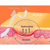 Hydrocolloid Adhesive Bandage, Hydrocolloid Wound Dressing Thin Type 4'' x 4'', Individually Sterile Packed Hydrocolloid Patches, Box of 10 Dressings