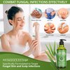 Antifungal Body Wash & Soap, Antibacterial Tinea Versicolor Body Wash, Tea Tree Back Acne, Folliculitis Body Wash, For Jock Itch, Athletes Foot, Body Odor, Ringworm