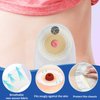 Ostomy Barrier Strips,Skin Barrier Strip,Elastic Ostomy Barrier Tape Waterproof Hydrocolloid Extenders Pressure Sensitive Sticker for colostomy Bags (40pcs)