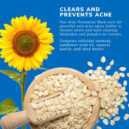 Earth's Care Acne Treatment Mask - 5% Sulfur Cystic Acne Treatment - Acne Medicine for Face Pimples and Blackheads 2.5 OZ (2 Tubes)