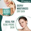 TreeActiv Salicylic Acid Face Moisturizer, 2 fl oz, Acne Treatment Face Cream for Oily Skin with and Tea Tree Oil, For Teens and Adults with Acne Prone Skin and Cystic Acne, 90 Day Supply