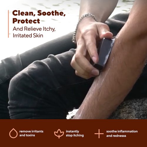 Marie Originals Itch Relief Soap Body Wash Bar - All Natural Instant Relief from Insect Bites, Chicken Pox, Chiggers and Other Skin Irritations ie. Anti- Itch Calming Soap