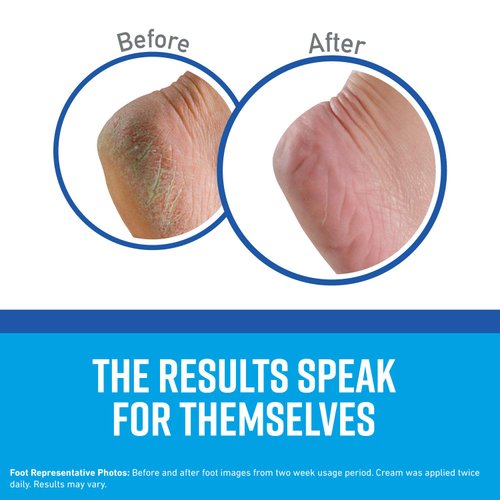 O'Keeffe's K0280004-3 Healthy Feet Foot Cream Tube (3 Pack), 3 oz