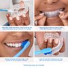 Teeth Whitening Gel for Trays, 4 Take Home Syringes, 35% Carbamide Peroxide, with Potassium-Nitrate, Trays Not Included, USA Made, Kosher Teeth Whitening Kit by Everest VAAS