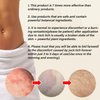 Jock Itch Cream: Extra Strength Jock Itch Treatment for Men and Women - Yeast Infection Treatment for Groin Inner Thighs - Yeast Infection Cream for Itchy Balls - Relief for Itchy Skin - 2.02 OZ