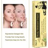 Moisturising Cream, Body and Face Moisturizer for Dry Skin, Acne Cream, 2PC