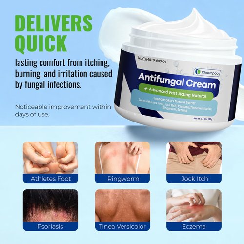 CHARMPOO Anti fungal Cream for Skin: 3-in-1 Antifungal Cream Advanced Fast Acting Formula for Feet Body Groin - Athletes Foot Treatment and Jock Itch Ringworm Treatment for Humans 3.4 oz (100g)