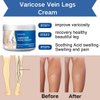 Uioecn 2Pcs Varicose Veins Cream, Skin Cream for Legs, Spider Varicose Veins ReliefCream