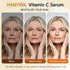HANYWIL Super Vitamin C Serum for Women over 70, Vitamin C Serum for Face, Dark Spot Remover for Face, Skin Care, Hyaluronic Acid Serum, Targets Age Spots, Hydrates and Wrinkle Reduction 1.7fl oz
