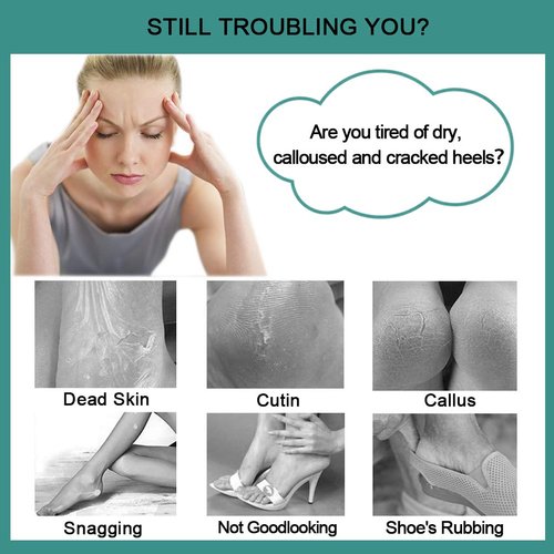 CAREHOOD Foot File Callus Remover - Multi Purpose 4 in 1 Feet Pedicure Tools with Foot Scrubber, Pumice Stone, Foot Rasp and Sand Paper for Home Foot Care (Red Pedicure Foot File)