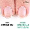 Maccibelle Cuticle Oil For Nails Refill size for Dry Cracked Cuticles (4 Ounce, Pineapple)